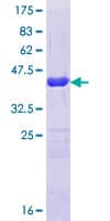Human ARFGEF1 Protein (Recombinant GST, N-terminus)