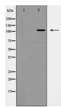 Polyclonal Rabbit anti-Human BMPR2 Antibody (WB)