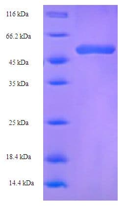 Actinidia deliciosa pKIWI502 Protein (Recombinant His-SUMO)
