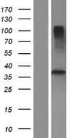 TMUB2 Protein (Over-Expression Lysate Myc-DDK (Flag))