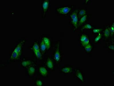Polyclonal Rabbit anti-Human EPHB3 / EPH Receptor B3 Antibody (IF, WB)