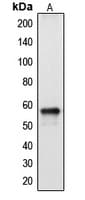 CYP2A13 Antibody (Internal)
