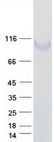 Human ITGB1 / Integrin Beta 1 / CD29 Protein (Recombinant Myc-DDK (Flag))
