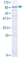Human IFNAR1 / IFNAR Protein (Recombinant GST)