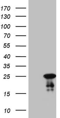 Monoclonal Mouse anti-Human ABCC5 / MRP5 Antibody (clone OTI1F3, WB)