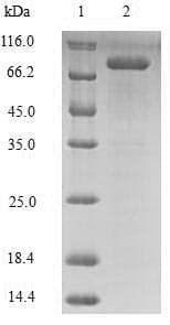 Human LOX / Lysyl Oxidase Protein (Recombinant MBP, N-terminus + 6His, C-terminus)