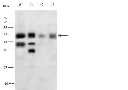 Polyclonal Rabbit anti-Human CTSB / Cathepsin B Antibody (Preservative Free, IHC, WB)