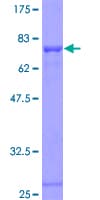 Human FRS2 Protein (Recombinant GST, N-terminus)