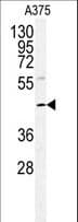 POLDIP2 / PDIP38 Antibody (aa105-133)