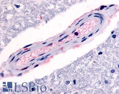 IHC-plus™ Polyclonal Rabbit anti-Human HTR4 / 5-HT4 Receptor Antibody (C-Terminus, IHC)