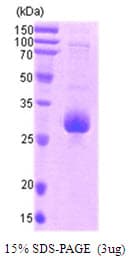 Human BIRC5 / Survivin Protein (Recombinant)
