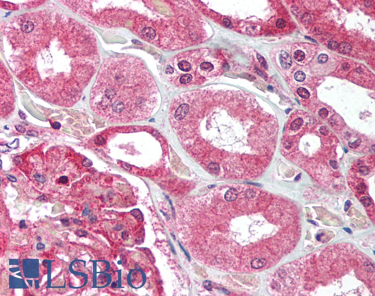 IHC-plus™ Polyclonal Rabbit anti-Human UBE2N / UBC13 Antibody (IHC, IF, WB)