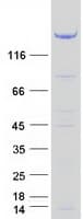 Human TBC1D4 / AS160 Protein (Recombinant Myc-DDK (Flag))