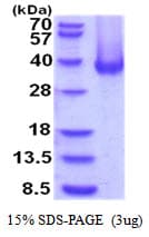 Human CA12 / Carbonic Anhydrase XII Protein (Recombinant His)