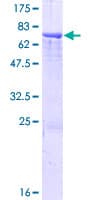 Human SPESP1 Protein (Recombinant GST)