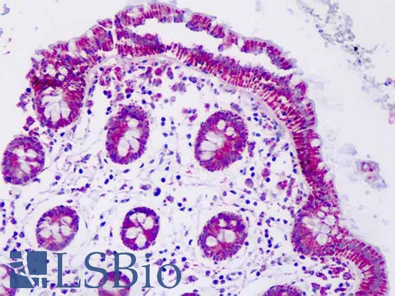 PathPlus™ SOD2 / Mn SOD Antibody