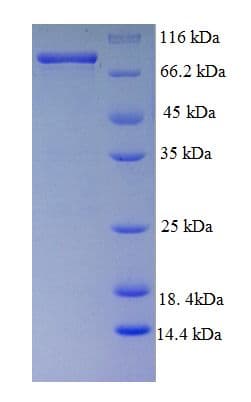 Human PAK1 Protein (Recombinant His-SUMO)