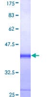Human EIF2AK2 / PKR Protein (Recombinant GST, N-terminus)