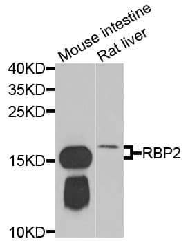 Polyclonal Rabbit anti-Human RBP2 / CRBPII Antibody (IHC, IF, WB)