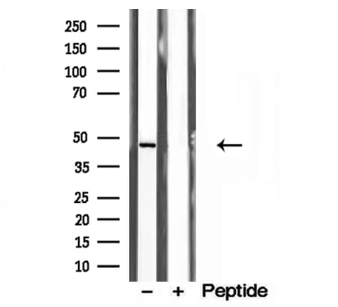 ANXA7 / Annexin VII / SNX Antibody