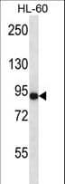 Polyclonal Rabbit anti-Human ADGRE5 / CD97 Antibody (aa707-736, IHC, WB)