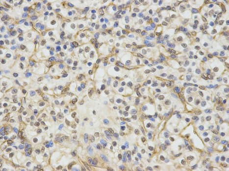 Polyclonal Rabbit anti-Human ERCC1 Antibody (IHC, IF, WB)