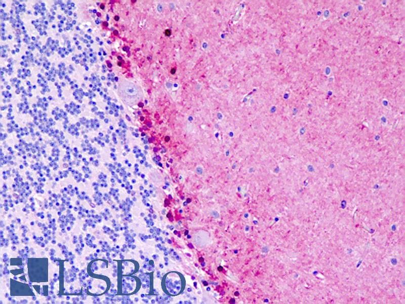 IHC-plus™ Polyclonal Rabbit anti-Human S100B / S100 Beta Antibody (aa28-56, IHC, WB)