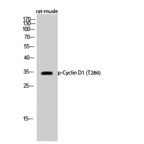 CCND1 / Cyclin D1 Antibody (220-300 aa)