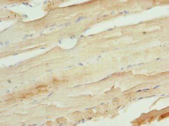 Polyclonal Rabbit anti-Human UFD1L Antibody (IHC, WB)