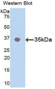 MAPK8 / JNK1 Antibody (aa145-419)