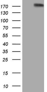 FLT4 / VEGFR3 Antibody (aa1063-1363, clone OTI8C2)