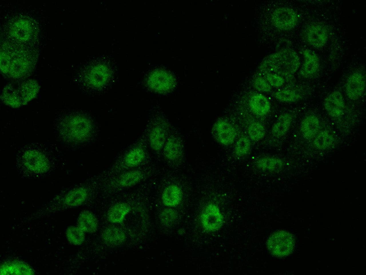 TET3 Antibody