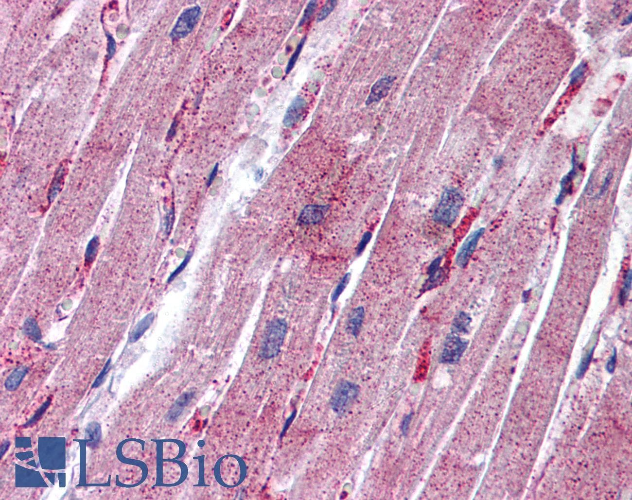 Polyclonal Rabbit anti-Human MLC2 / MYL9 Antibody (C-Terminus, IHC, WB)