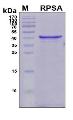 Human RPSA / Laminin Receptor Protein (Recombinant 6His, N-terminus)