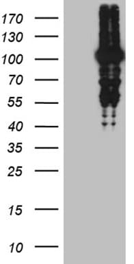 MLH1 Antibody (aa1-298, clone OTI10F9)