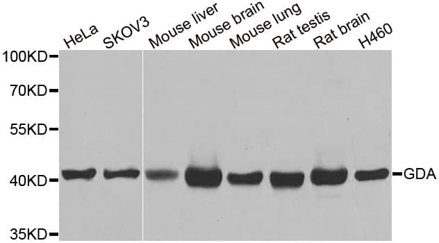 GDA / Nedasin Antibody