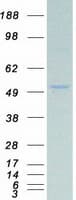 Human PAX8 Protein (Recombinant Myc-DDK (Flag))