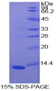 Bovine S100A10 Protein (Recombinant His)