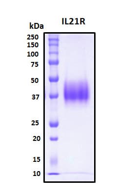 Human IL21 Receptor Protein (Recombinant His, N-Terminal)
