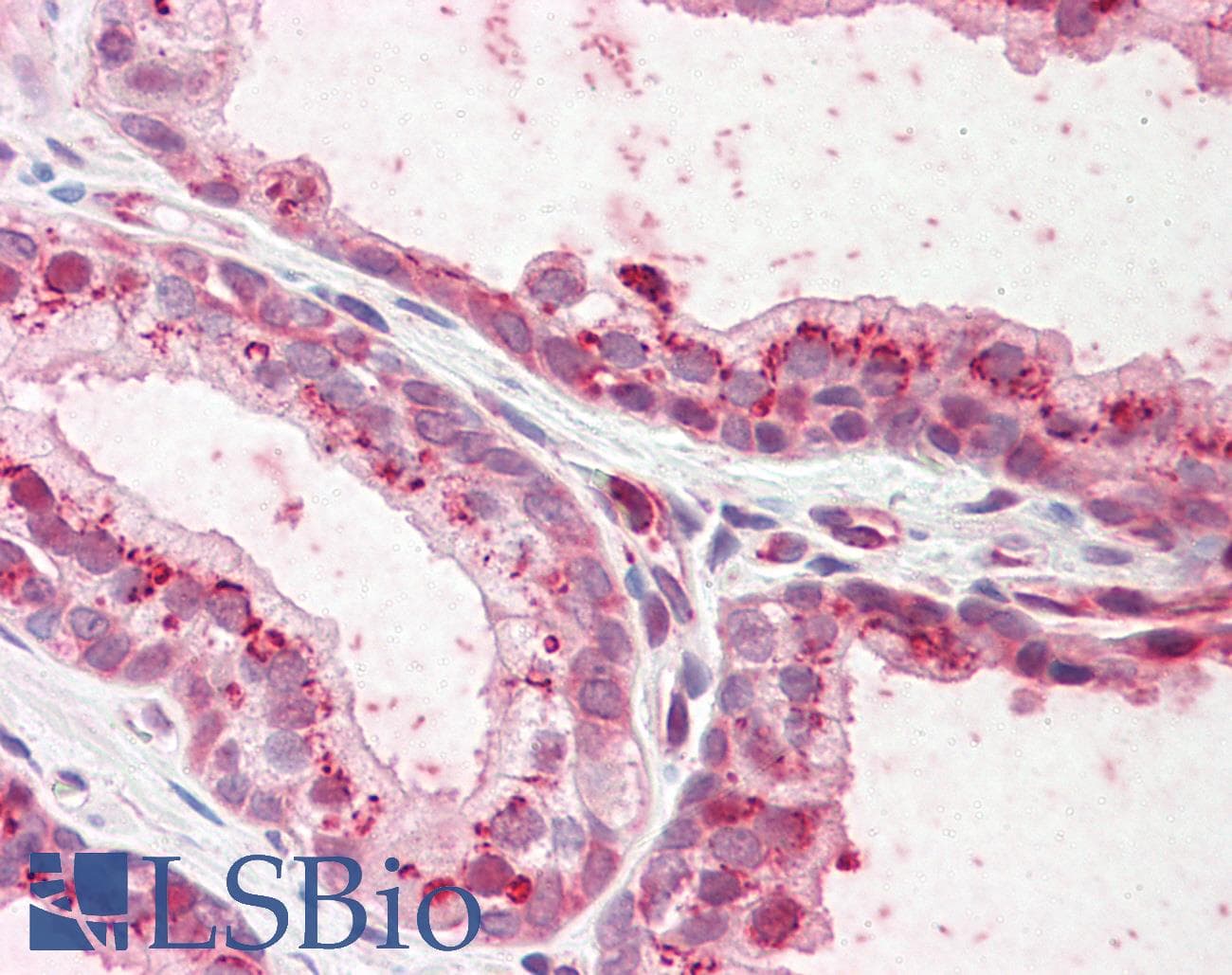 IHC-plus™ PKP2 / Plakophilin 2 Antibody (aa125-139)
