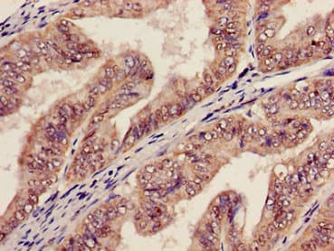 AGPAT5 Antibody