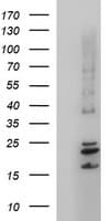 CLDN6 / Claudin 6 Antibody (clone OTI3G3)