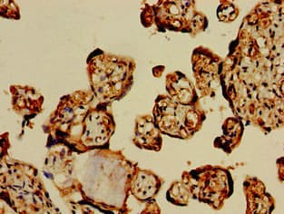 IHC-plus™ Polyclonal Rabbit anti-Human GPC1 / Glypican Antibody (IHC, IF)