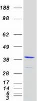 Human TNNT1 / TNT Protein (Recombinant Myc-DDK (Flag))