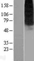 SLC29A1 / ENT1 Protein (Over-Expression Lysate Myc-DDK (Flag))
