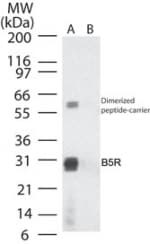 Polyclonal Rabbit anti-Variola Virus Smallpox-B5R Antibody (aa180-194, WB)