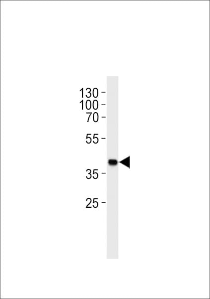 SH2D5 Antibody (aa200-230)