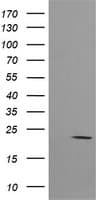HRAS / H-Ras Antibody (clone OTI2A1)