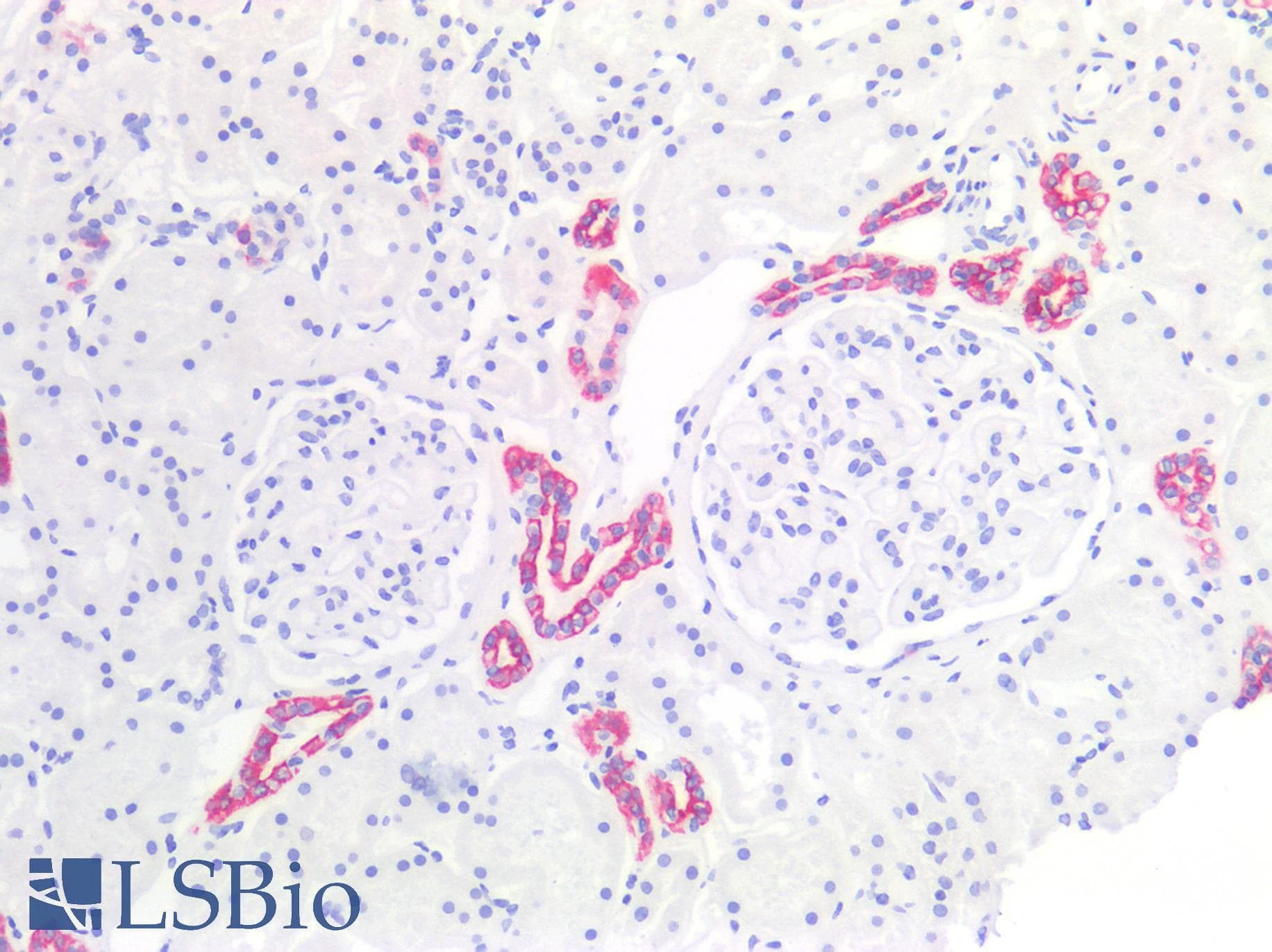 PathPlus™ KRT19 / CK19 / Cytokeratin 19 Antibody (clone A53-B/A2)