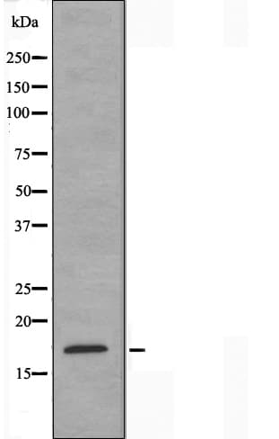 Polyclonal Rabbit anti-Human NK1 / CD160 Antibody (IF, WB)
